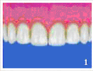 110_Чистка зубов 1.jpg